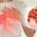 Ilustrasi Pneumonia (foto/net)