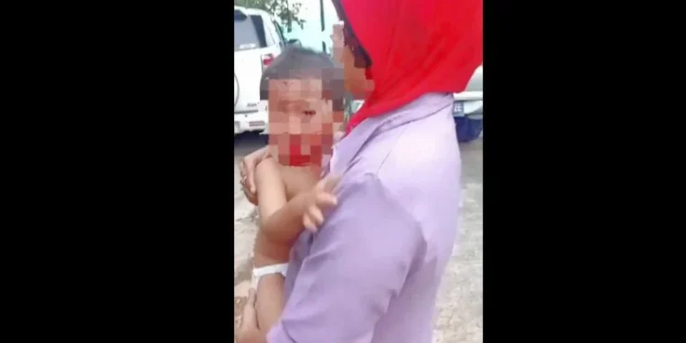 Anak balita yang berdarah dianiaya sang ibu. (foto/ist)