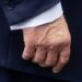 Donald Trump didiagnosis menderita insufisiensi vena kronis setelah mengalami pembengkakan. (Foto/Doc)