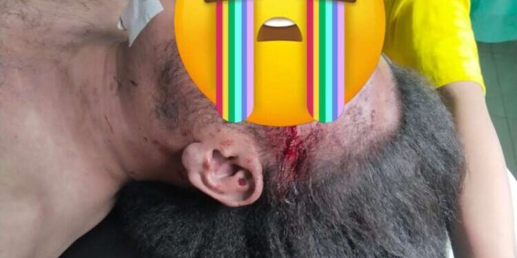 Jurnalis di Medan Tewas dengan Sejumlah Luka di Tubuh. (Foto/Doc)