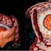 Penampakan bunga Rafflesia hasseltii yang sangat langka di Sumatera Barat. (Foto/Doc)