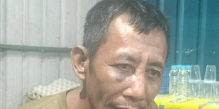 Supir lori barang yabng dihajar oknum Bea Cukai Telaga Punggur. (Foto/Istimewa).