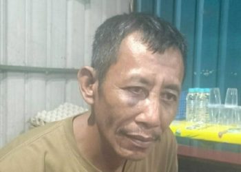 Sukarman yang dihajar 5 Oknum Petugas Bea Cukai Punggur Hingga Babak Belur. (Foto?Istimewa).