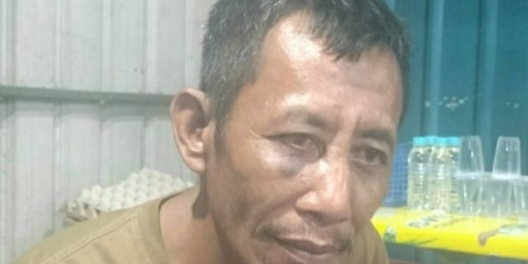 Sukarman yang dihajar 5 Oknum Petugas Bea Cukai Punggur Hingga Babak Belur. (Foto?Istimewa).